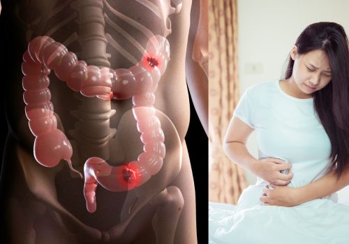 ۱۰ نشانه پنهان مشکلات گوارشی که نباید نادیده بگیرید